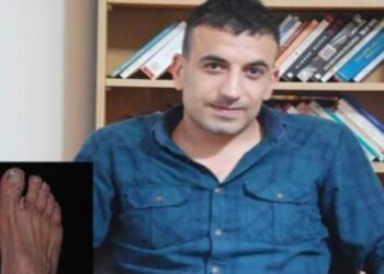 Muhabirin ayaklarını kartını eriterek yaktılar, 2 gün işkence ettiler